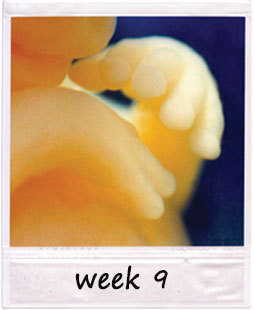 9 week fetus 9 week fetus